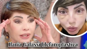 Ilaria Galassi di Non è la Rai Guardate Miei Occhi Sono Bellissima dopo Intervento Estetico