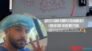 Andreas Muller e il trapianto di capelli: “Non si torna più indietro!”, il ballerino affronta la sua insicurezza con coraggio