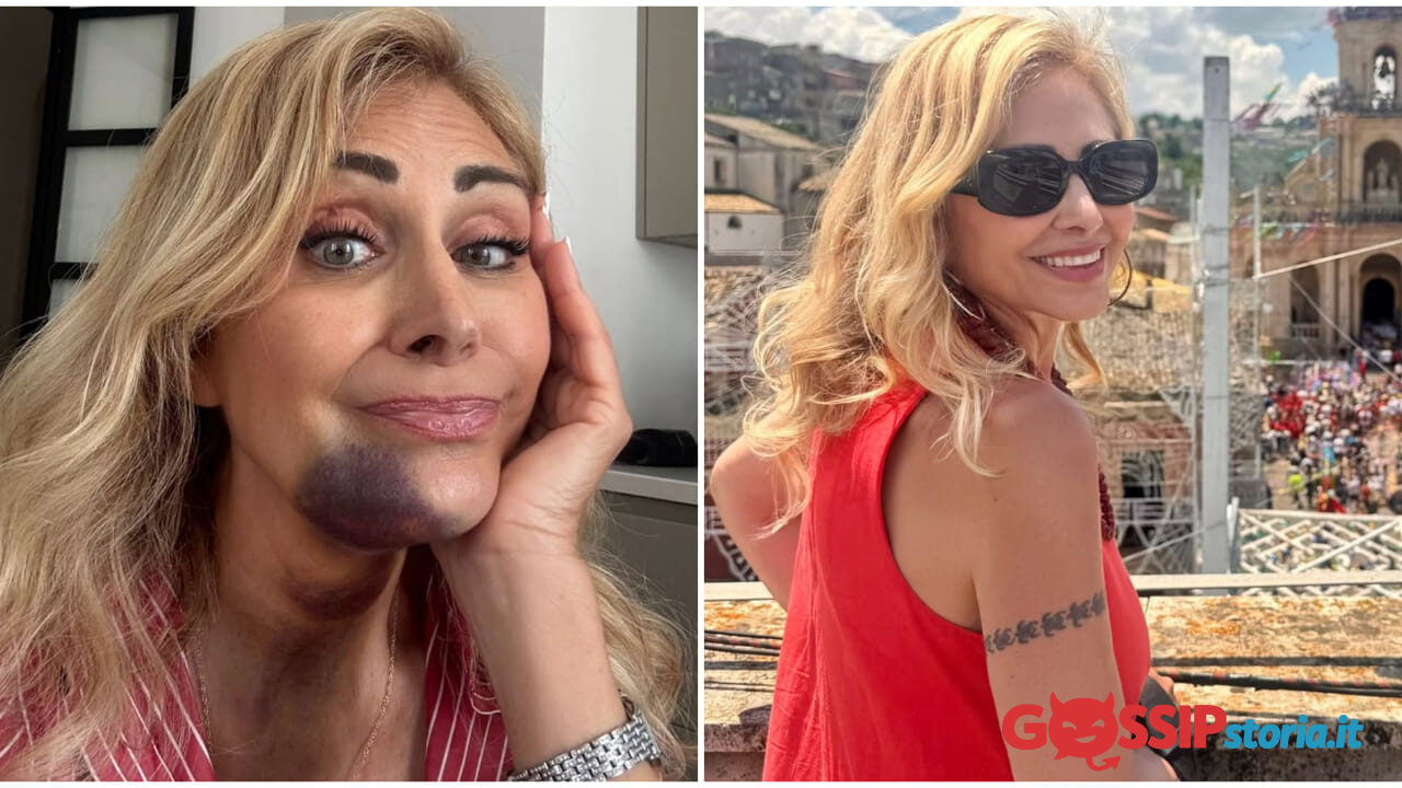 "Spero che l'ematoma passi presto, come la paura": Marina Di Guardo, mamma di Chiara Ferragni, racconta l'incidente dietro l'assenza social degli ultimi giorni
